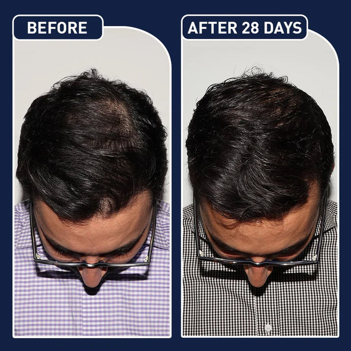 FEG Plus Beard & Hair Growth Spray