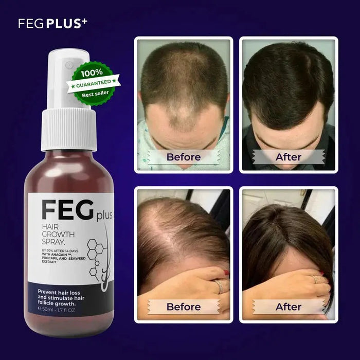 FEG Plus Beard & Hair Growth Spray