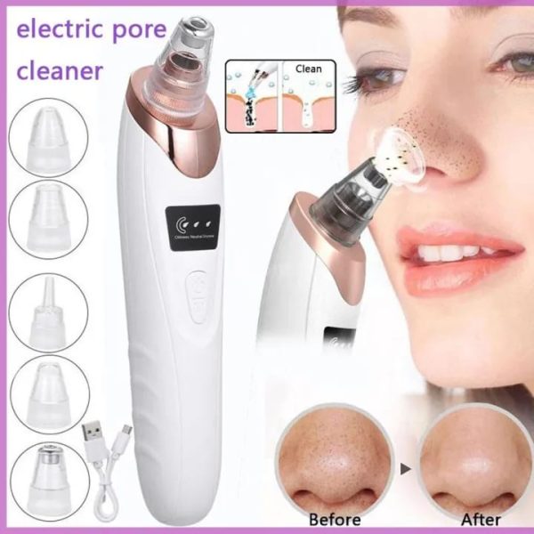 Face Vacuum Blackhead Remover Pore Cleaner | Electric Deep Cleansing Tool For Nose & Face