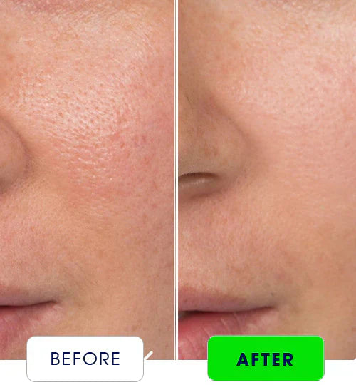 Dermive Oil-Free Moisturizer – Ultimate Skin Hydration | Best Oil-Free Formula for Healthy Glow