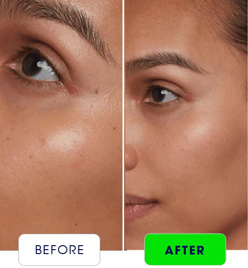 Dermive Oil-Free Moisturizer – Ultimate Skin Hydration | Best Oil-Free Formula for Healthy Glow